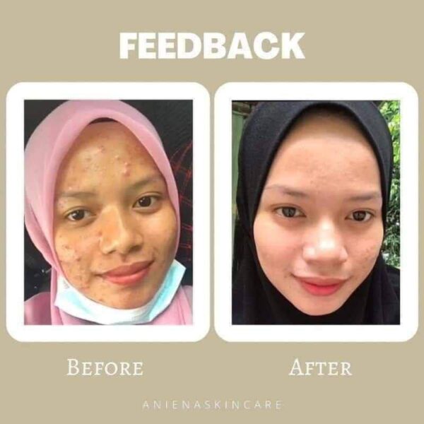 ANIENA SKINCARE - SET - Image 6